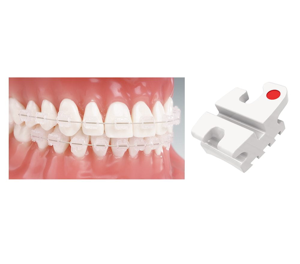 Orthodontic Product Suppliers ORTHOMAX Australia