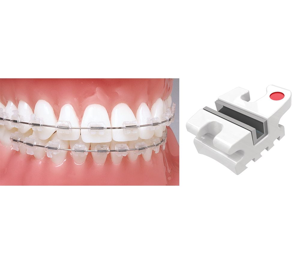 Orthodontic Product Suppliers ORTHOMAX Australia