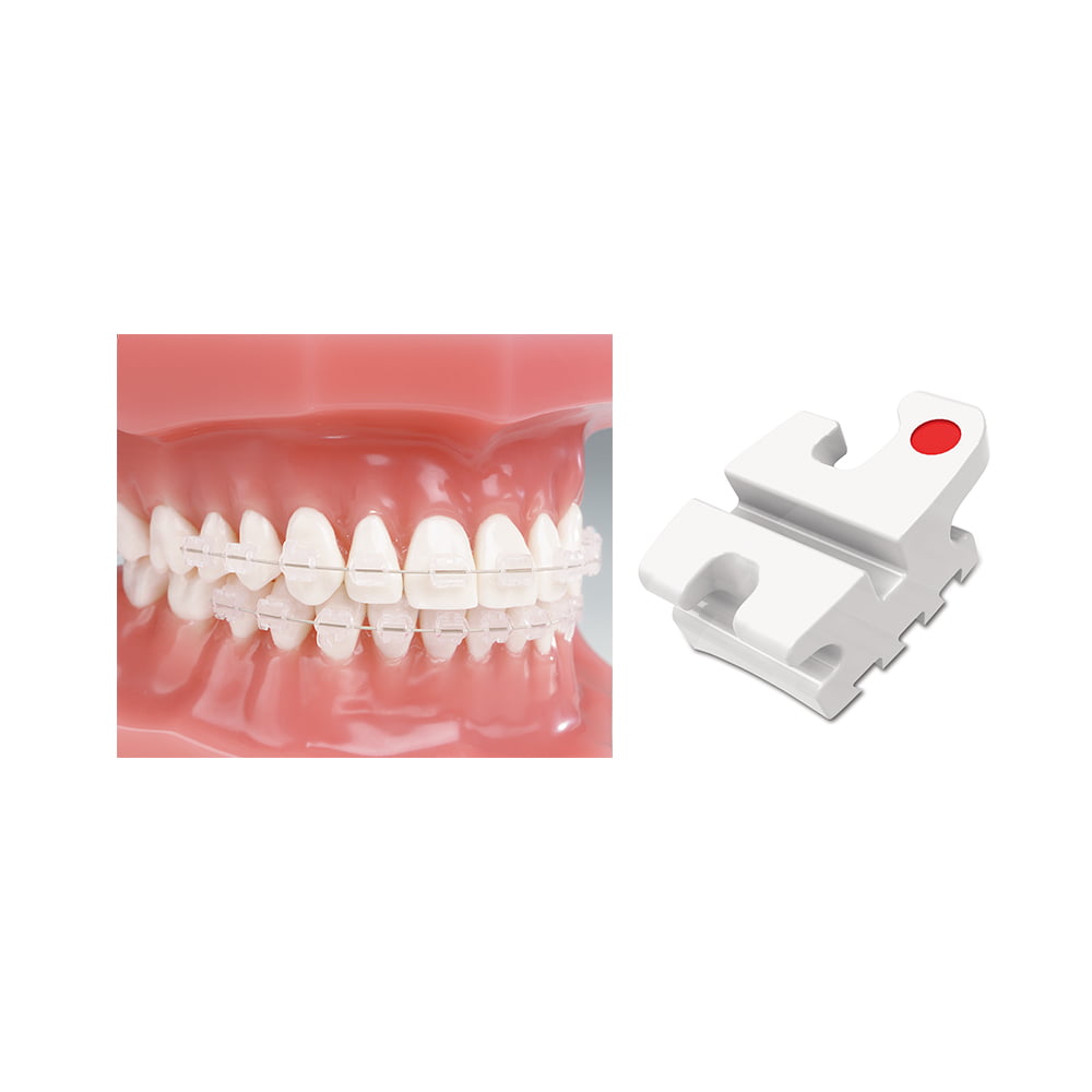 Reflections Ceramic Bracket Kits ORTHOMAX Australia