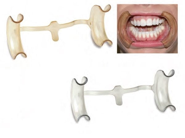 INTRAORAL CHEEK RETRACTORS