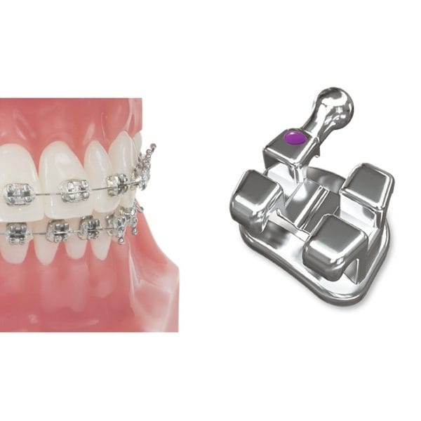 VOTION BRACKETS